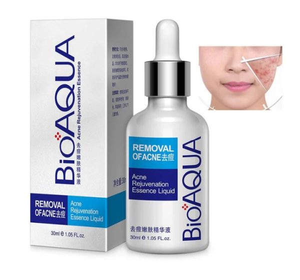 Bioaqua Anti-acne Serum Removal Of Acne Essence Liquid 30ml