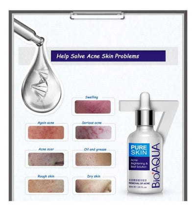 Bioaqua Anti-acne Serum Removal Of Acne Essence Liquid 30ml